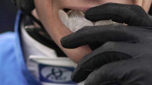 Dental injuries first aid, plus should riders wear mouthguards