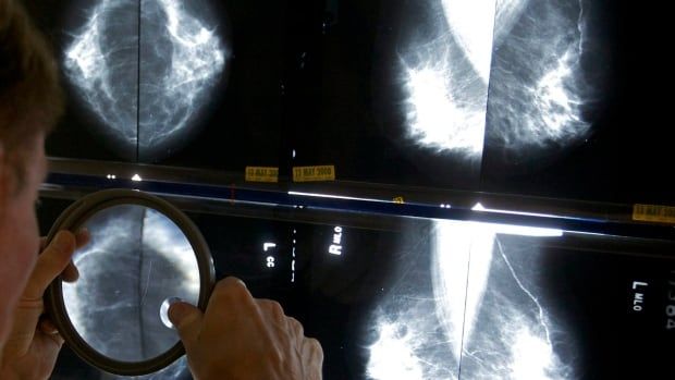 radiologist looks at mammogram