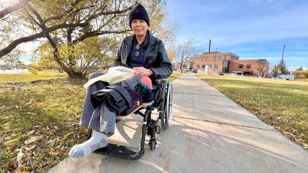 A man sits in a wheelchair outside a hospital. His leg was recently amputated below his knee.