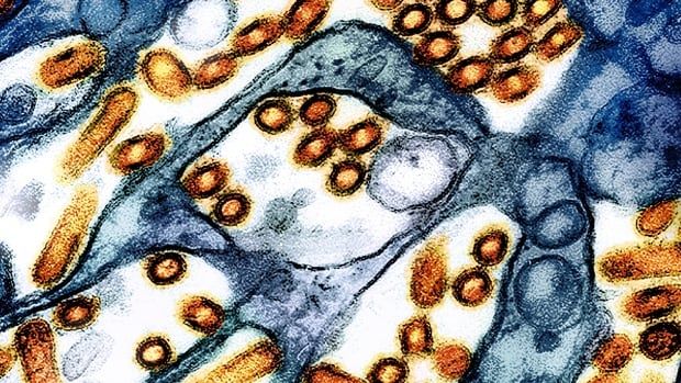 A colourized electron microscope image provided by the U.S. National Institute of Allergy and Infectious Diseases in 2024 shows avian influenza A virus (bird flu) particles, red/yellow, grown in cultured cells.  