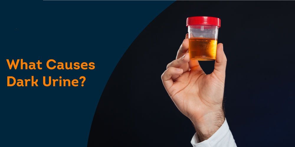 Why your urine looks darker in the morning [PristynCare]