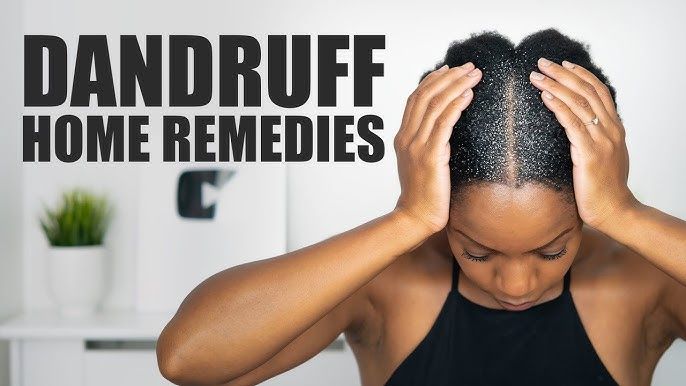 Home remedies for getting rid of dandruff [YouTube]