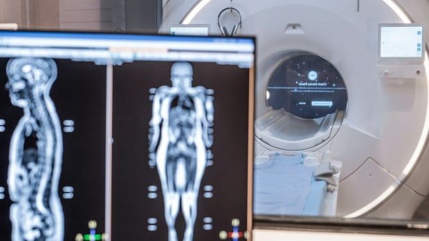 A full-body MRI machine operated by Prenuvo, behind a computer screen showing whole-body scans of a patient.