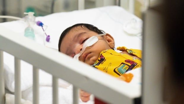 A child suffering from an RSV at a pediatric intensive care unit in Germany.