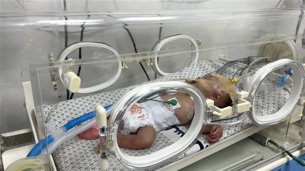 An infant in a hospital incubator.