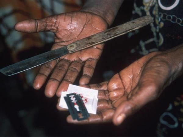 Genital mutilation: Photo used to illustrate the story