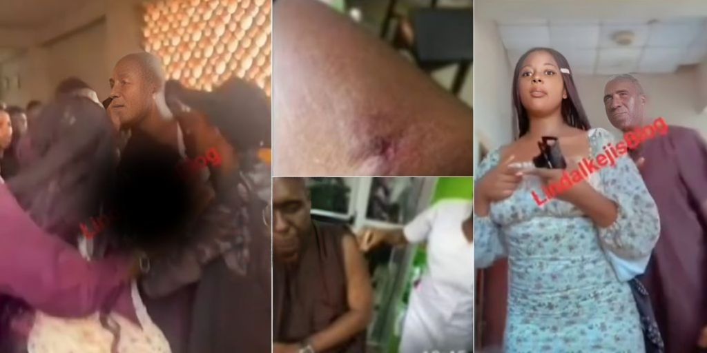 Unizik student bites lecturer